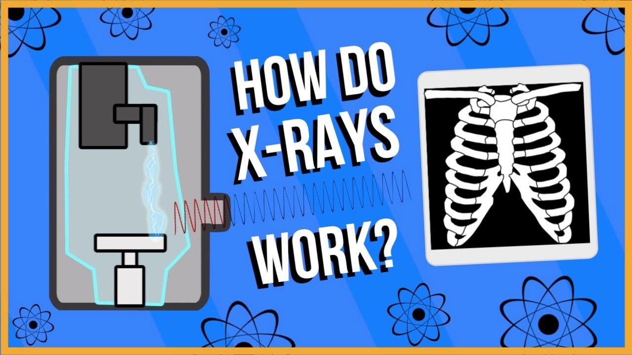 how to dispose of x rays